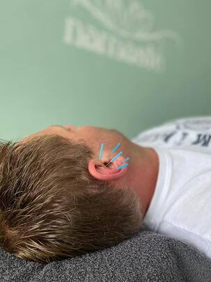 Anwendung Ohrakkupunktur